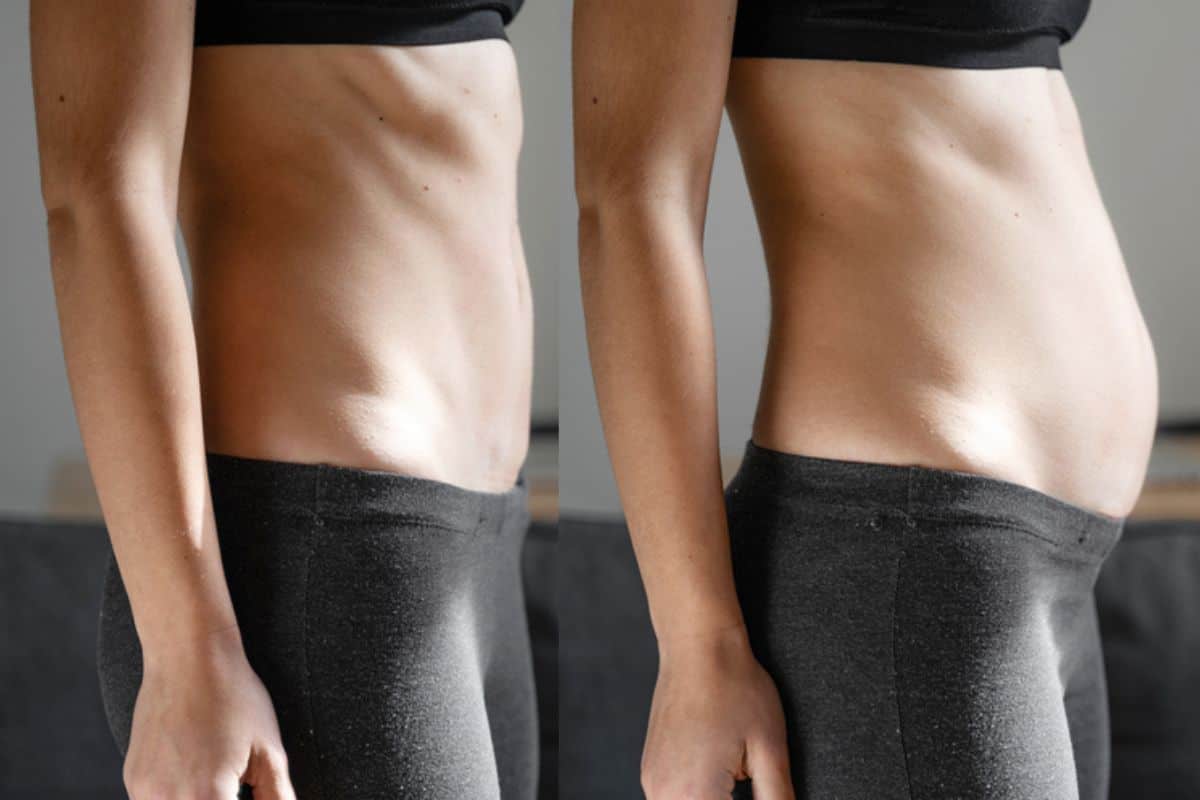 How long does diastasis recti take to improve Golders Green?