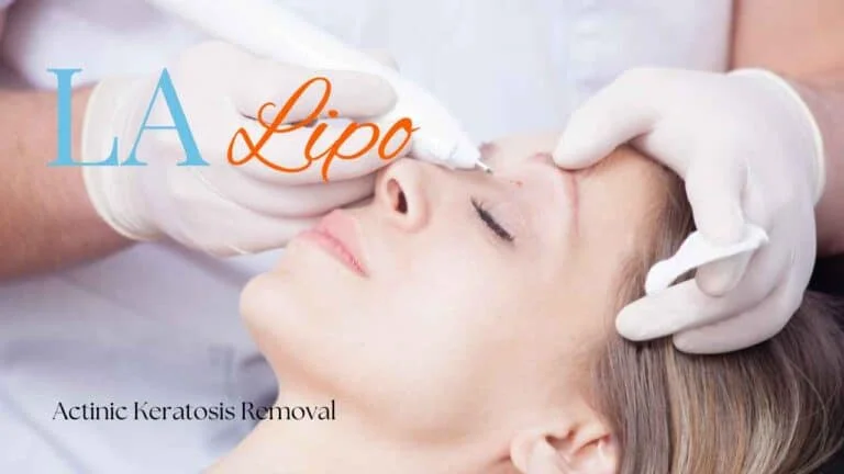 Woman receiving Actinic Keratosis Removal Treatment Golders Green