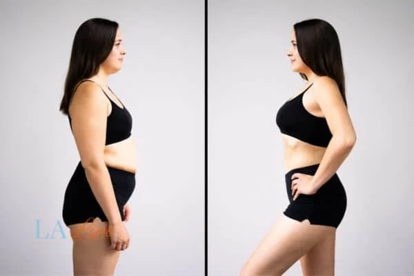 link between body image and mental health Golders Green
