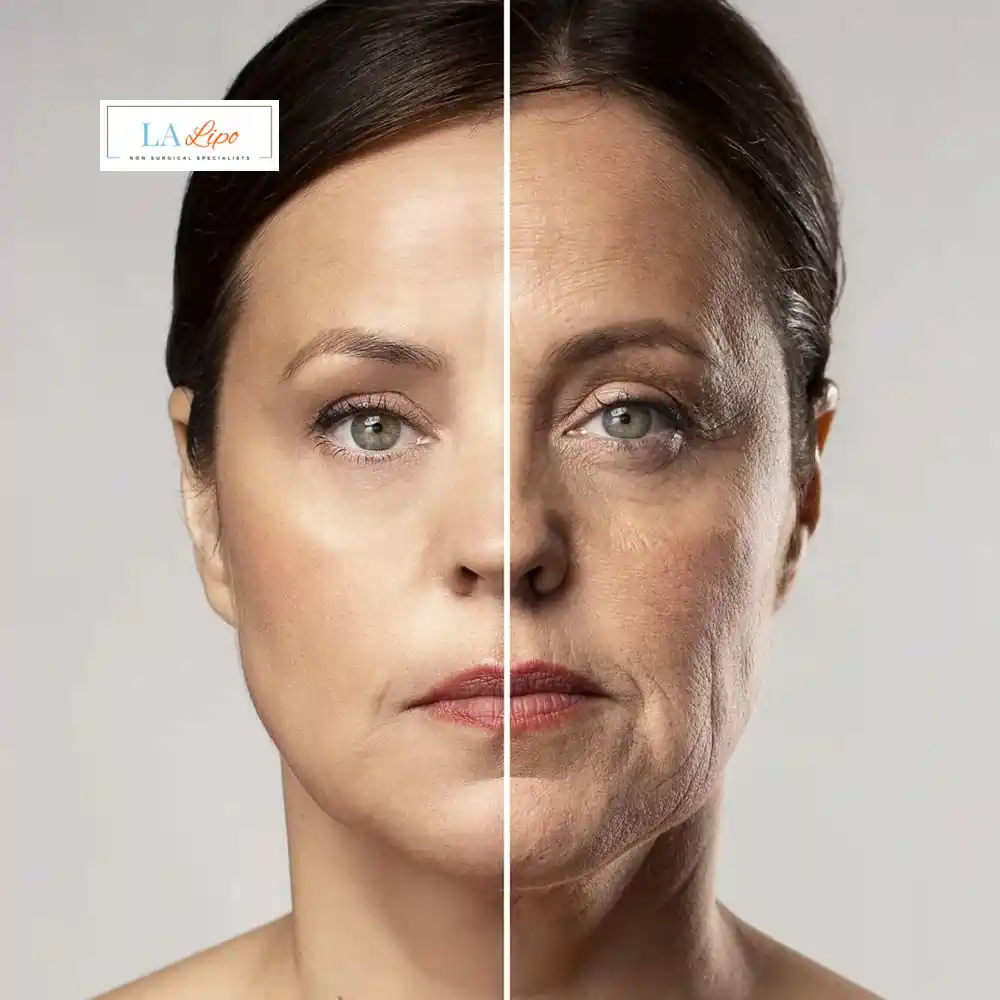 How Can You Tell If Non-Surgical Skin Tightening Is Right for You Golders Green?