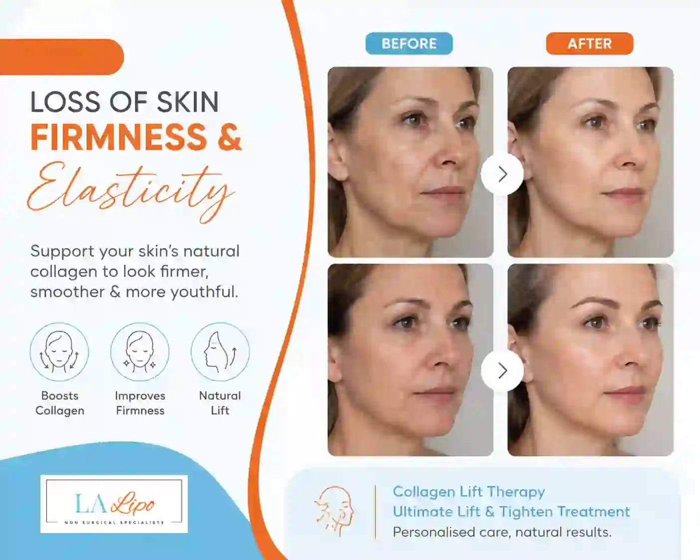 Sign #7: Loss of Skin Firmness and Elasticity Golders Green