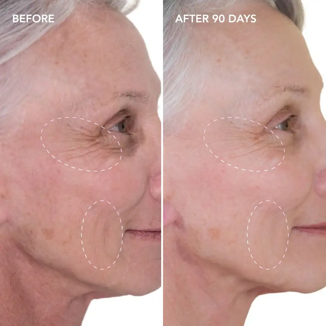 When will you see results Golders Green
